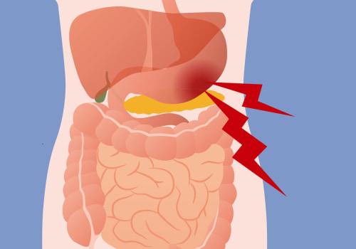 Coping Strategies for Dealing with Abdominal Pain in Cyclic Vomiting Syndrome